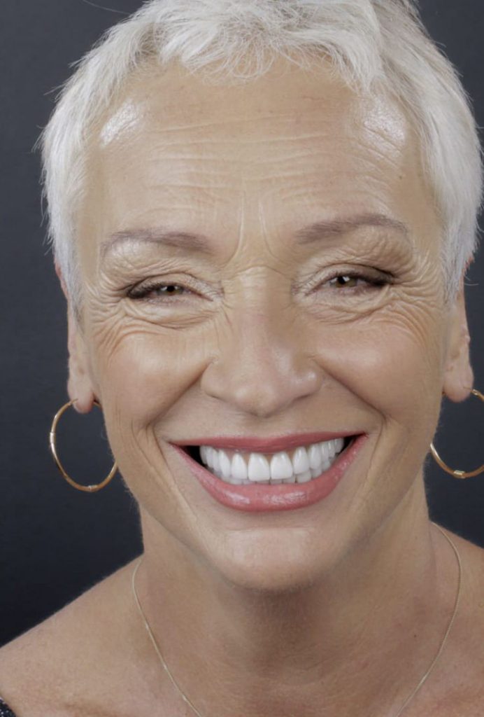 dental-implant-10